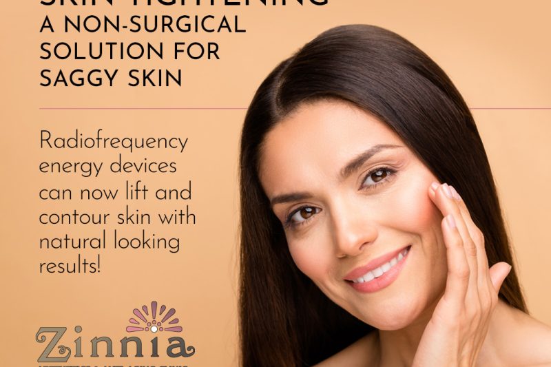 Radio Frequency Skin Tightening