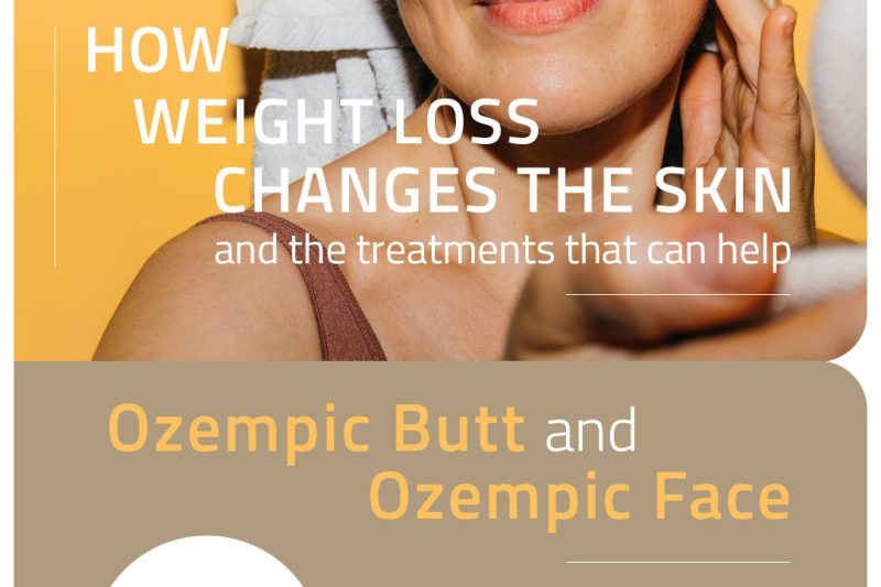 How Weight Loss Changes the Skin, and the Treatments That Can Help “Ozempic Butt and Ozempic Face