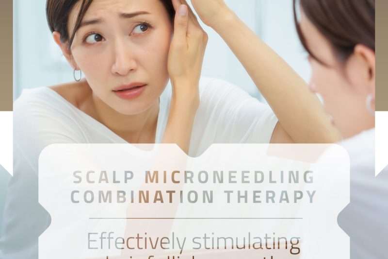 Scalp Microneedling Combination Therapy Effectively Stimulating Hair Follicle Growth