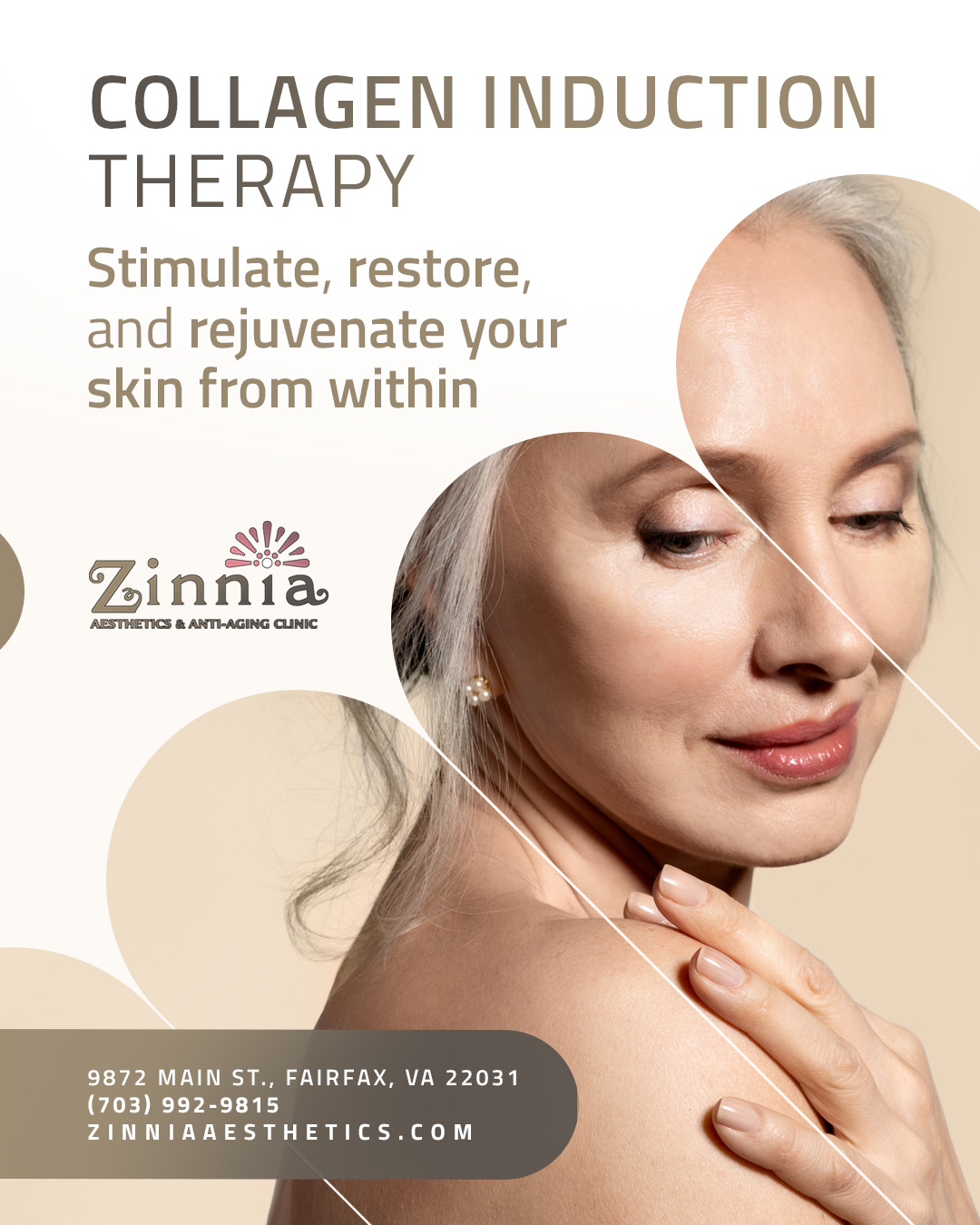 Collagen Induction Therapy at Zinnia Aesthetics and Anti-Aging Clinic Stimulate, Restore, and Rejuvenate Your Skin from Within