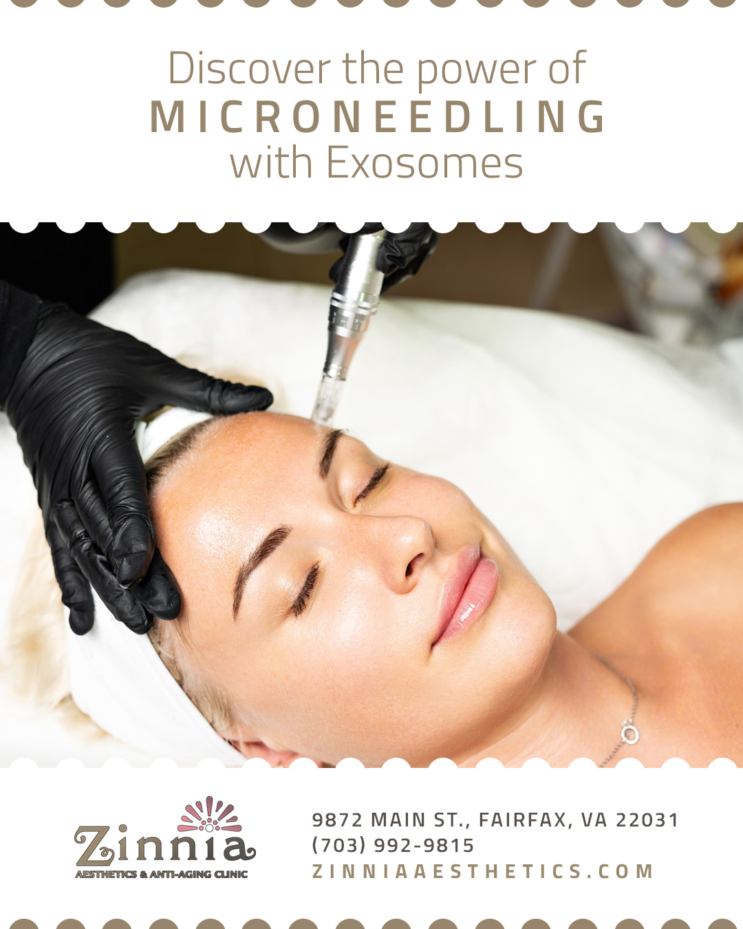 Discover the Power of Microneedling with Exosomes at Zinnia Aesthetics in Northern VA