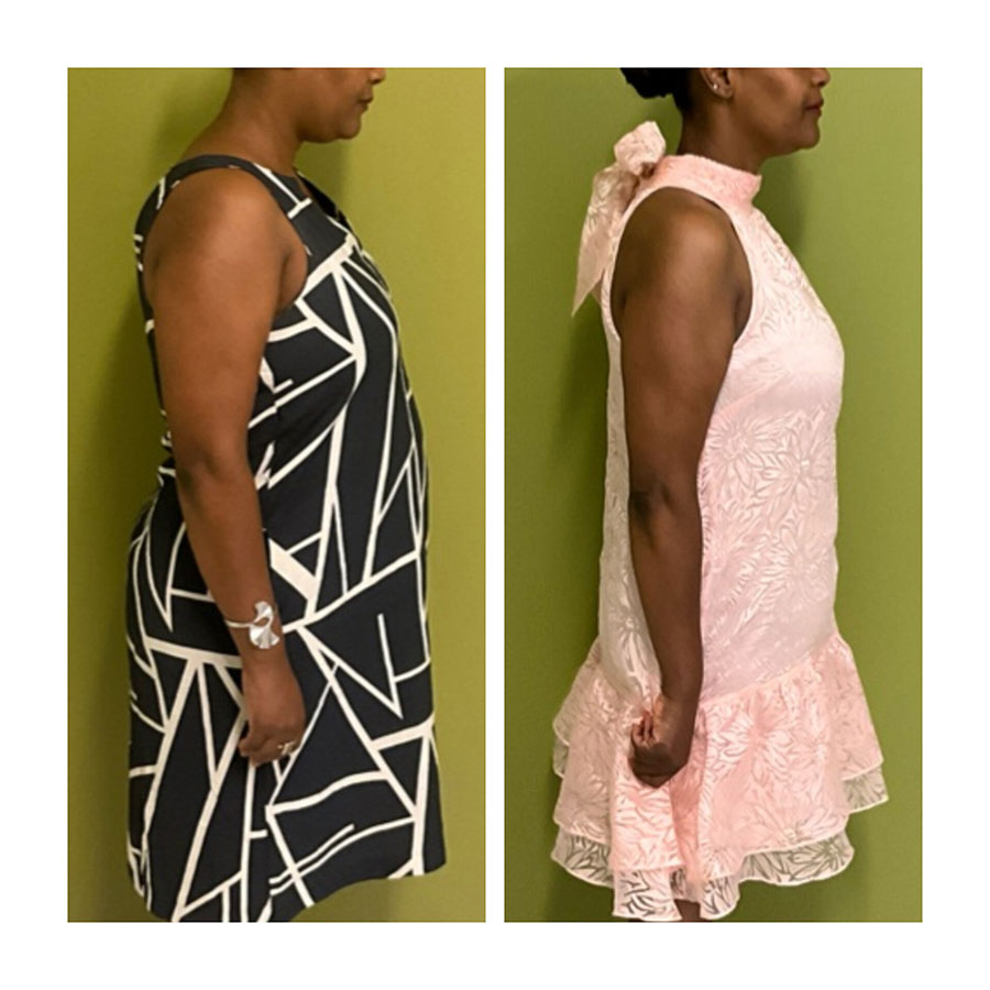 Medical Weight Loss Gallery