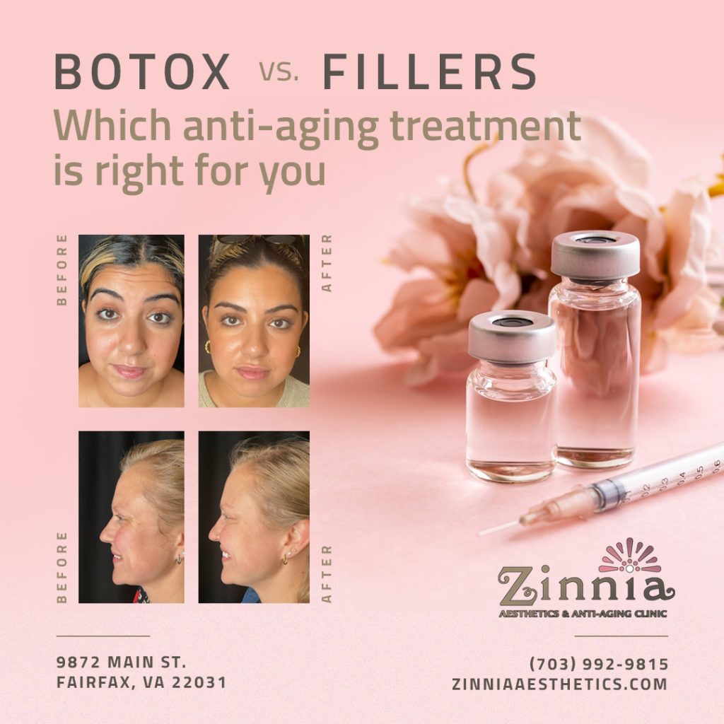 Botox vs. Fillers: Which Anti-Aging Treatment Is Right for You?