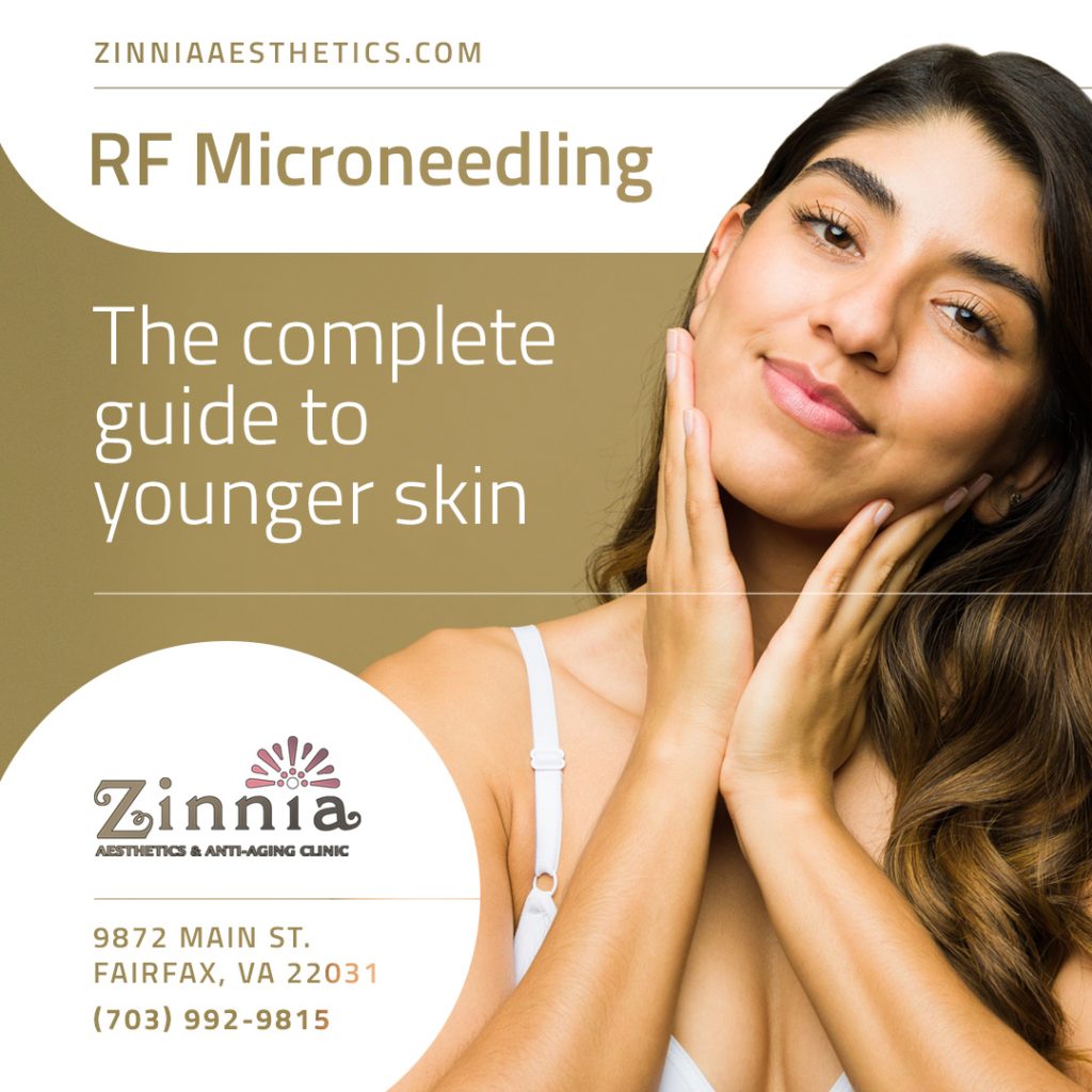 RF Microneedling in Fairfax, VA: The Complete Guide to Younger Skin