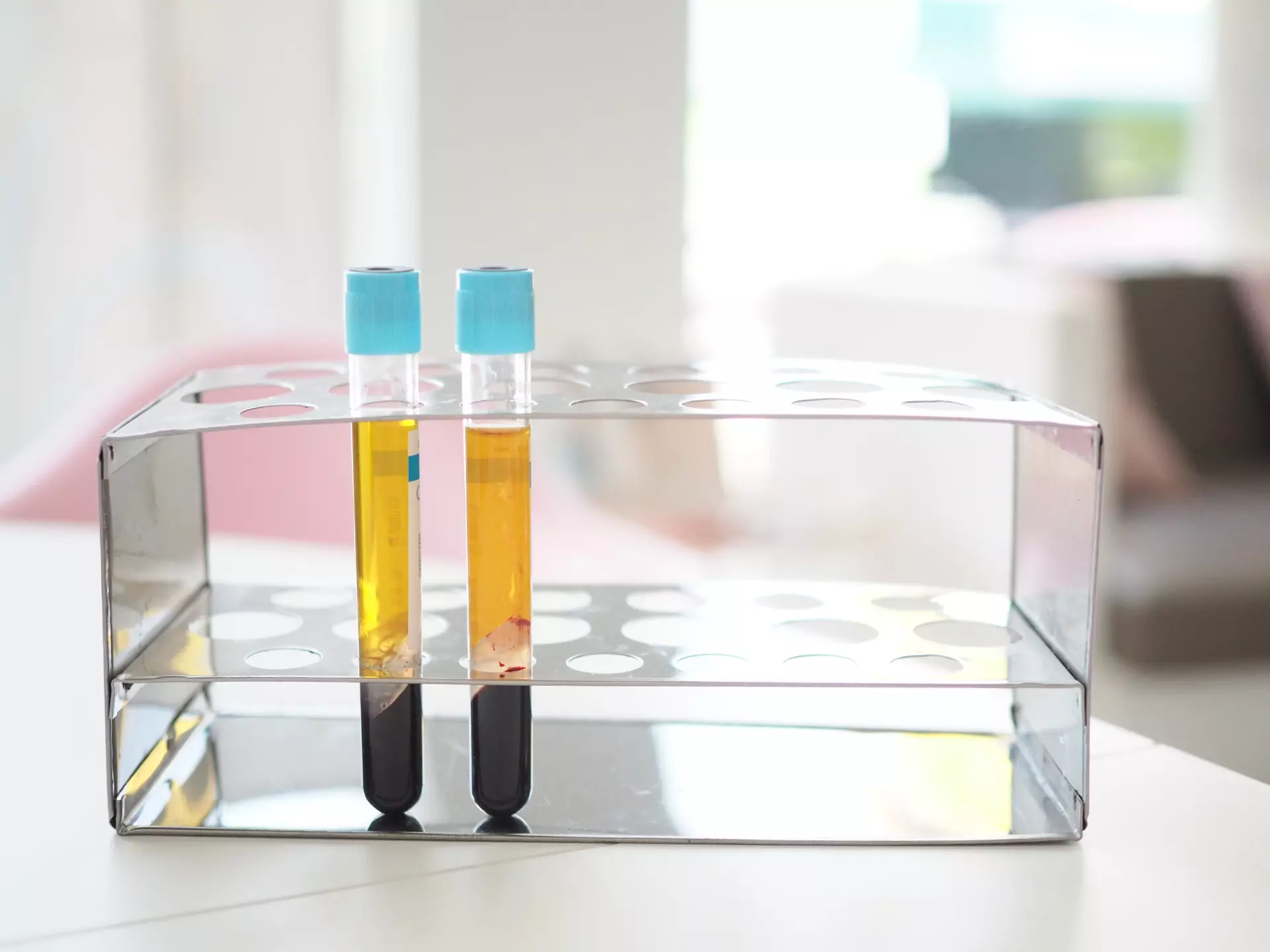 DMV Platelet-Rich Plasma Treatment